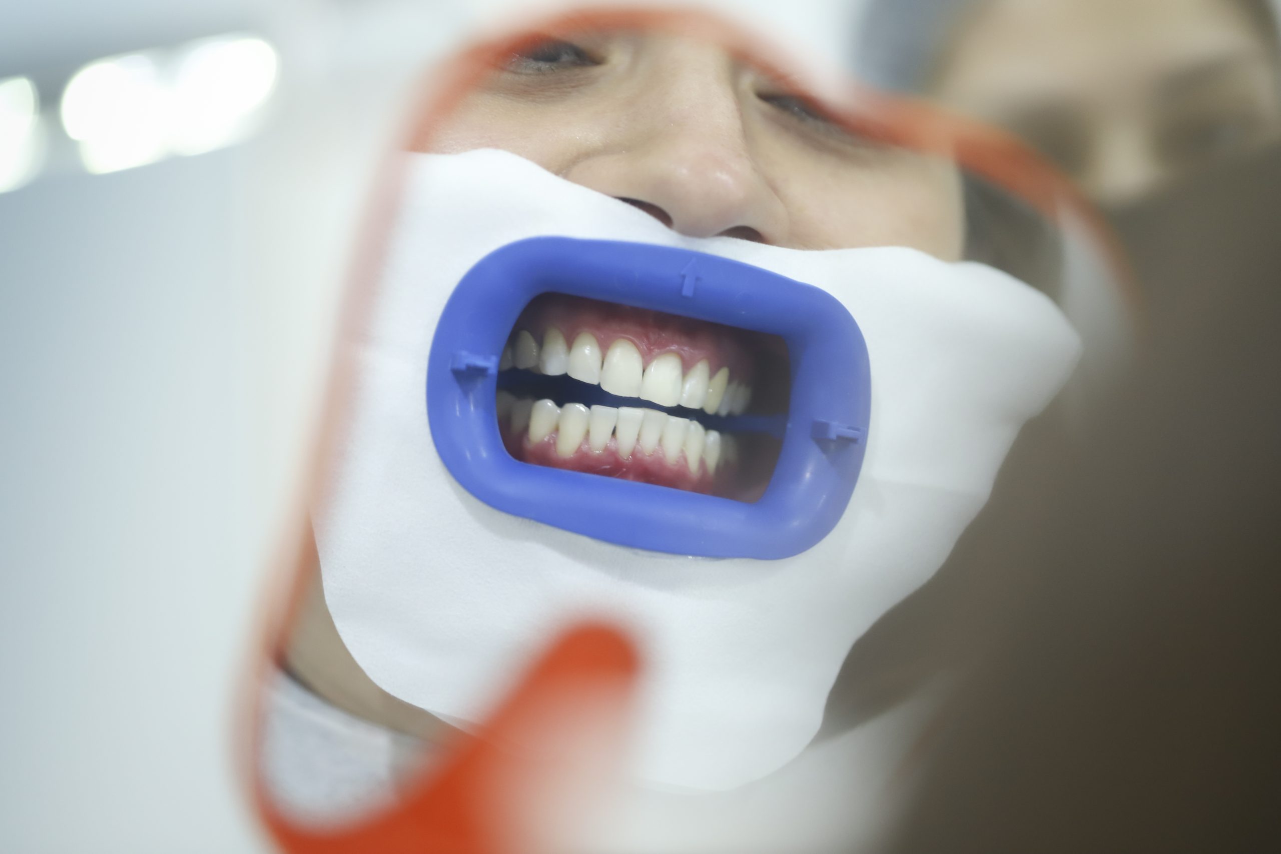 Gunay zoom 100-02378